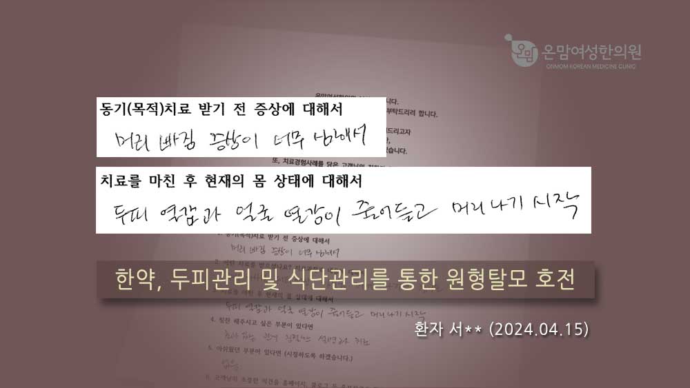 탈모 자필후기 서화신님.jpg