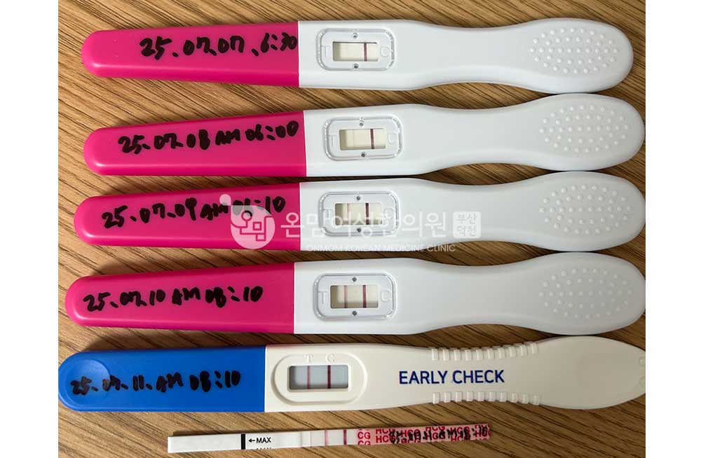 김미정-습관성유산-임신_임테기.jpg
