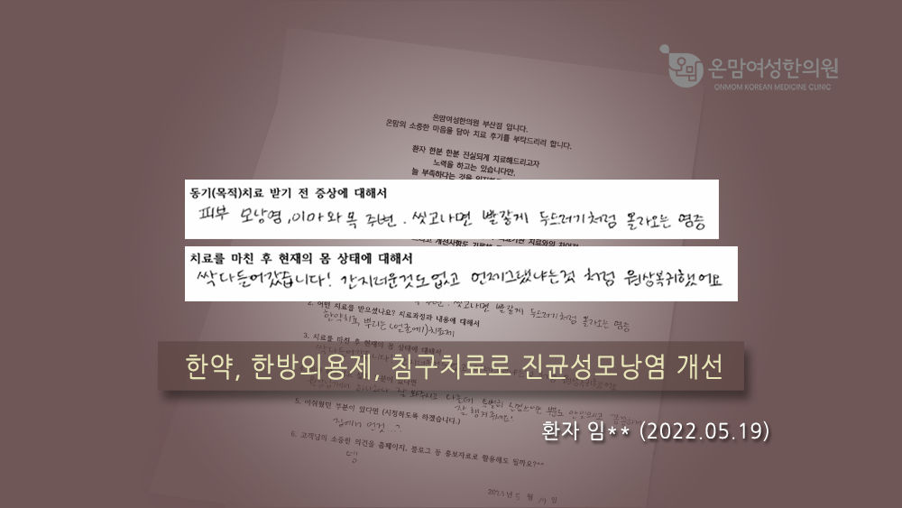 자필후기-모낭ㅇㅁ.png