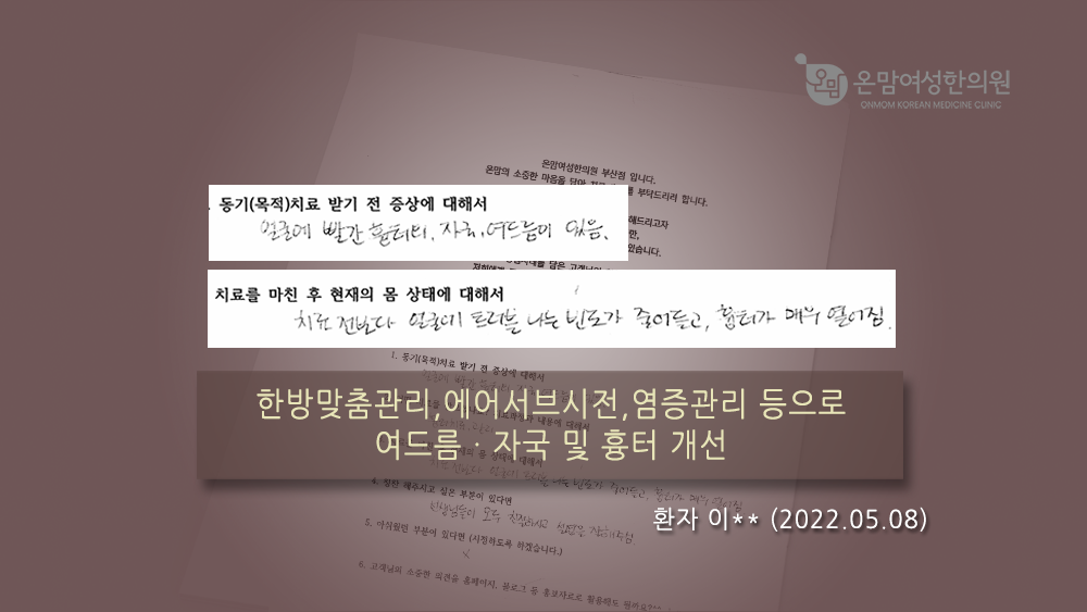 자필후기-여드름-이민지님.png