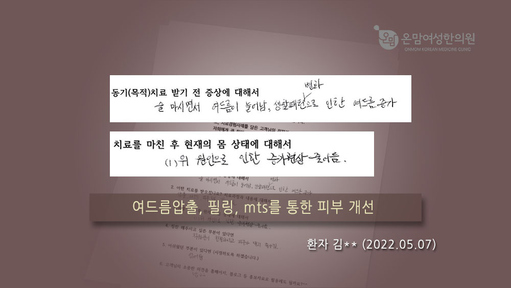 여드름 자필후기 김동규님.jpg