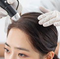 자궁내막증식증 이미지
