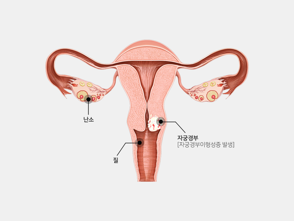 이미지입니다