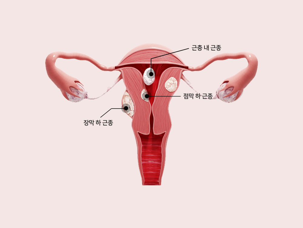 이미지입니다
