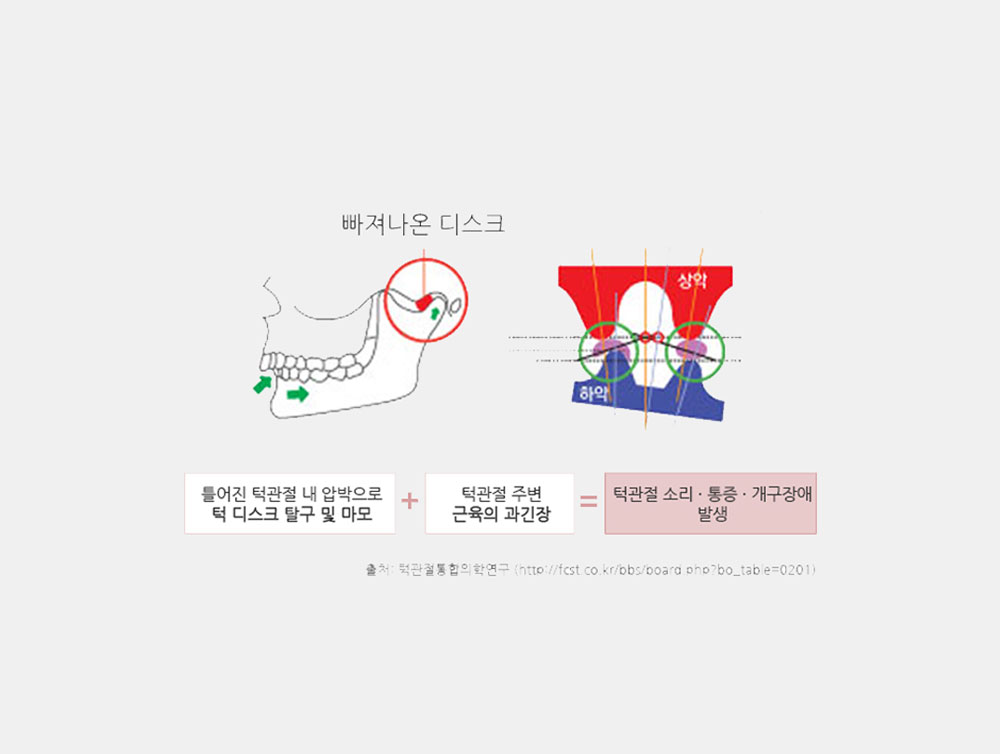 이미지입니다