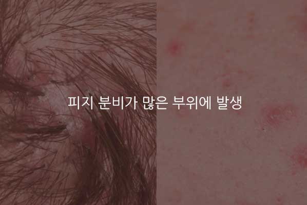 이미지입니다