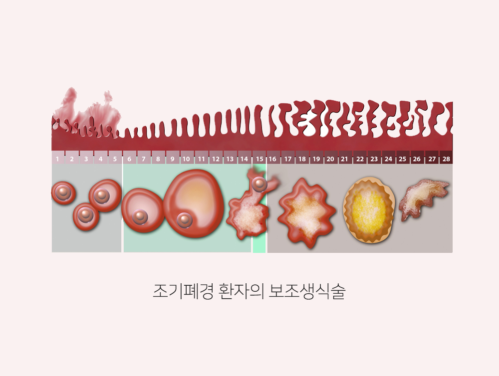 이미지입니다