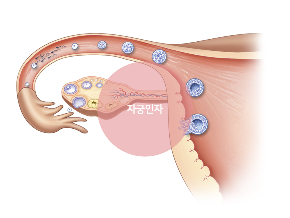 이미지입니다
