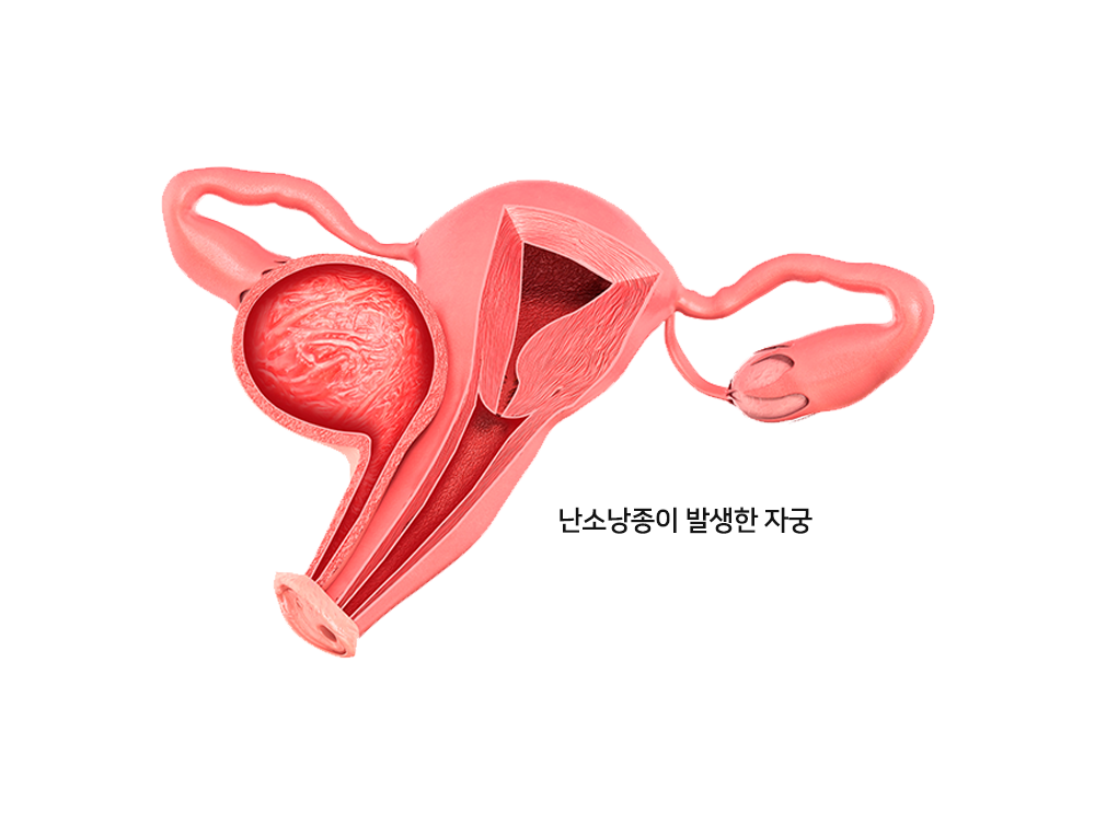 이미지입니다