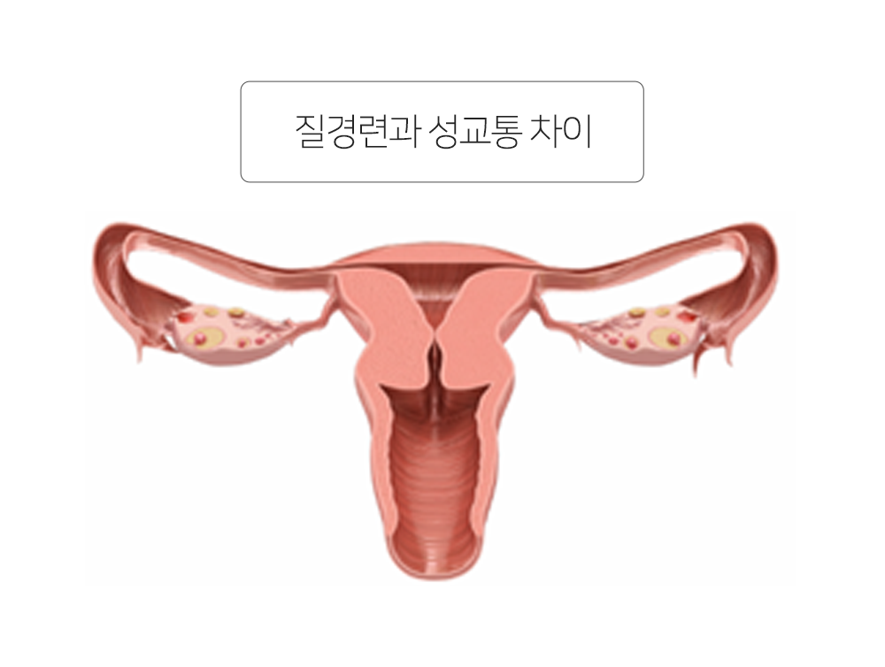 이미지입니다
