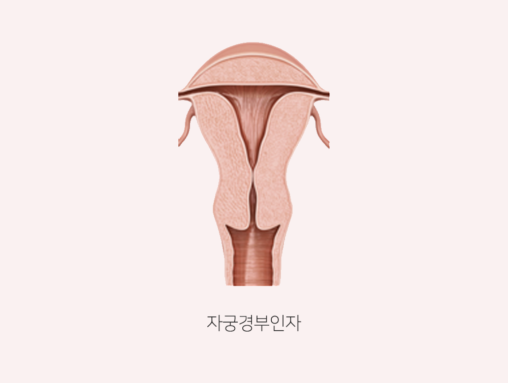 이미지입니다