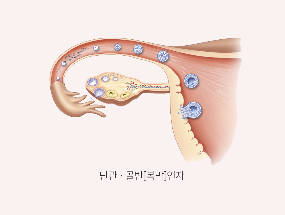 이미지입니다