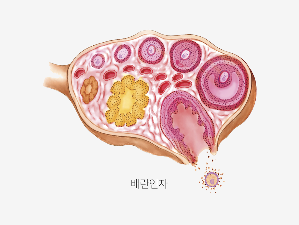 이미지입니다